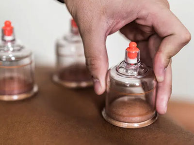 انواع قاپک و معرفی انواع قاپکها بر اساس جنس و ساختار و کاربرد و پارامترهای موثر در انتخاب و خرید قاپک و قیمت قاپک با مشاوره رایگان و سفارش آنلاین انواع قاپک قاپک شیشه انواع قاپک app قاپک سرامیک قاپک لباس چیست قیمت قاپک قاپک سنگ - کاربردهای پزشکی و دندانپزشکی